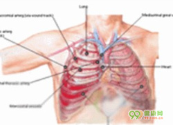 胸部创伤